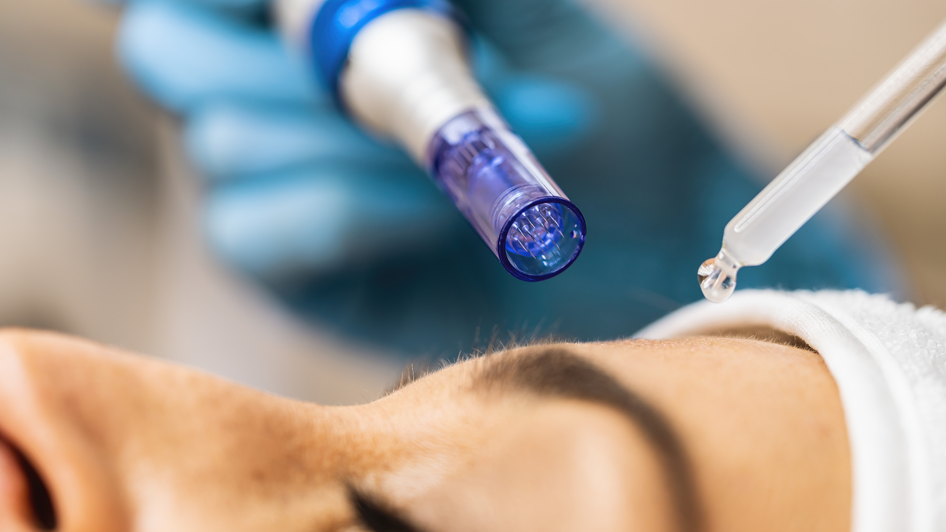 FinHud - Behandlinger Microneedling