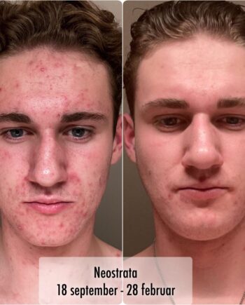 Konsultasjon med individuelt program